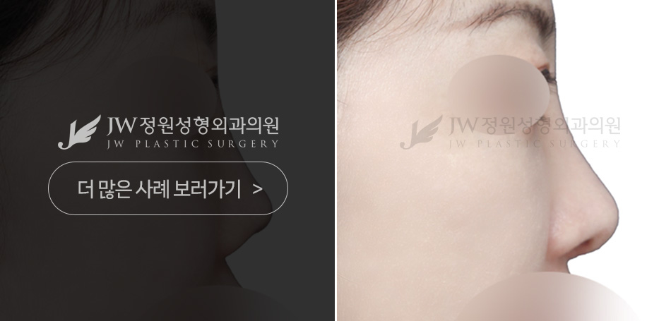 정원성형외과 코재수술 기능 진단