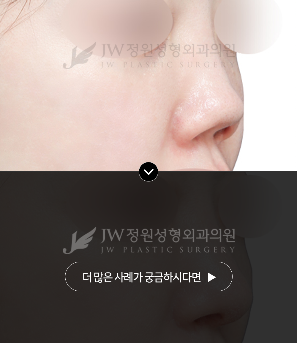 정원성형외과 코재수술 병원 내부