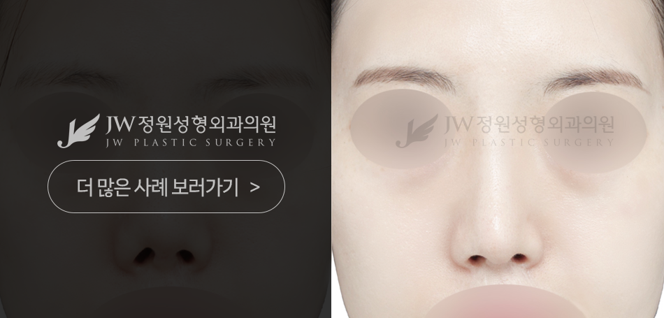 정원성형외과 재수술 진단 우선