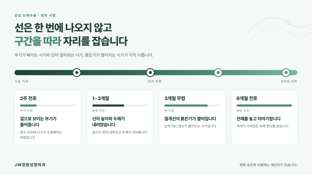 강남 눈재수술 후 2주·1개월·3개월·6개월 시점별로 부기와 선이 자리 잡는 진행 정도를 가로 진행 바로 정리한 JW정원성형외과 자료 이미지